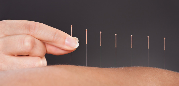 Einteilung der Akupunkturpunkte