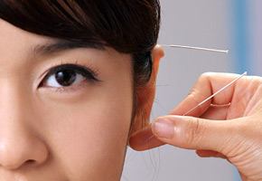 Die Ursprünge der Akupunktur liegen in China
